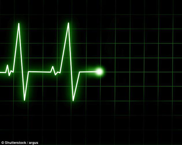 人死亡后大腦仍可活動10分鐘:呈深度睡眠腦電波
